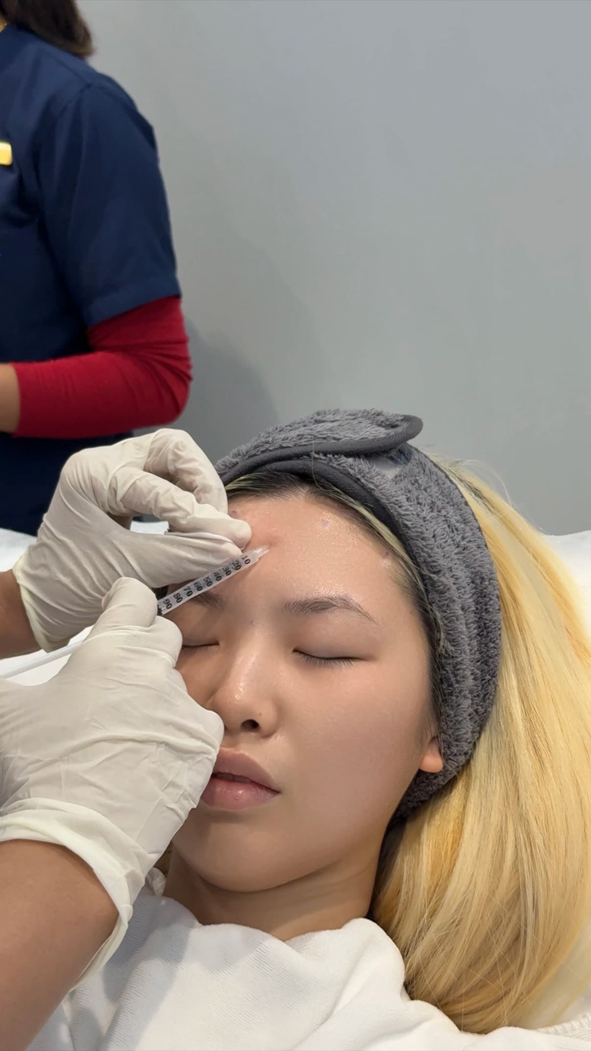 Botox - Full Face